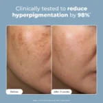Conscious Chemist Trubiom Pigmentation & Dark Spots Treatment Serum - Image 3