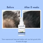 WishCare Hair Growth Serum Concentrate - Image 8