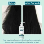 WishCare Ceramide Anti Dandruff Conditioner | Reduces Dandruff & Scalp Itchiness - 200 ML - Image 3