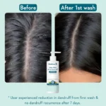 WishCare Hydrating Anti Dandruff Shampoo | 100% Dandruff Reduction - 250ml - Image 7
