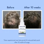WishCare Hair Growth Serum Concentrate - Image 9