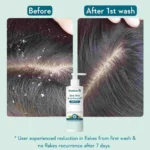 WishCare Hydrating Anti Dandruff Shampoo | 100% Dandruff Reduction - 250ml - Image 8