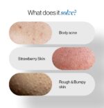 Be Bodywise 1% Salicylic Acid Body Wash | Prevents Body Acne & Exfoliates Skin | With Chamomile Extract | 100ml - Image 2