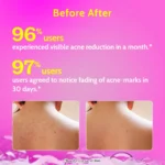 Chemist At Play 1% Salicylic Acid Body Wash for Acne Control - Image 4