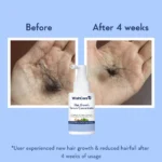 WishCare Hair Growth Serum Concentrate - Image 10