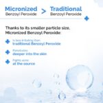 The Derma Co 2.5% Benzoyl Peroxide Gel Face Wash - Image 4