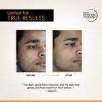 Deconstruct 10% Vitamin C Serum for Glowing Skin with Liposomal Technology | Clinically Tested - Image 5