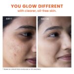 Foxtale 2% Salicylic Acid Face Wash for Oily & Acne Prone Skin - Image 3