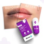 The Derma Co 1% Kojic Acid Lip Balm with SPF 50 PA +++ I With Arbutin & Peptide Complex - Image 6