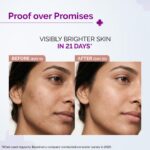 The Derma Co 10% Vitamin C Face Serum - 30ml - Image 3