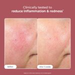 Conscious Chemist Azicalm Face Cream with 10% Azelaic Acid - Image 2