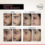 Deconstruct Dark Spot Clearing Serum with Liposomal Technology | 5% Niacinamide & 2% Alpha Arbutin | Clinically Tested - Image 5