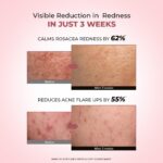 Conscious Chemist Azicalm Face Cream with 10% Azelaic Acid - Image 4
