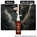 Soulflower Tea Tree Anti-Dandruff Scalp Serum - Image 6