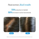 Be Bodywise Rosemary Hair Growth Serum (Roll On) - 25ml - Image 9