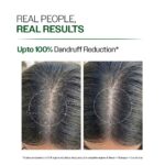 Bare Anatomy Anti-Dandruff Shampoo with Salicylic Acid, Piroctone Olamine & Biotin - Image 7