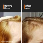 Minimalist Hair Growth Serum With 3% Redensyl, 3% Anagain, 3% Procapil, 5% Capixyl & 4% Baicapil 18% Hair Growth Actives - Image 3