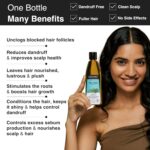 Soulflower Tea Tree Hair Oil | Hair Growth, Scalp Nourishment, Anti Dandruff 225 ML - Image 6