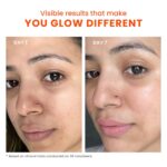Foxtale SPF 70 Niacinamide Dewy Sunscreen with PA++++ For Dewy Sun Protection - Image 8