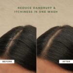 Naturali Australian Tea Tree Non-Drying Dandruff Defence Shampoo 370 ml - Image 5