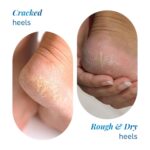 Be Bodywise 20% Urea Foot Cream Roll On 50ml | For Dry & Cracked Heels - Image 3