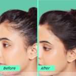 The Plant Fix Plix Rosemary Advanced Anti HairFall Shampoo for Decreases Hair Fall & Breakage - 200 ML - Image 5