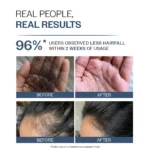 Bare Anatomy Anti-Hair Fall Shampoo with Adenosine & Peptides - Image 5