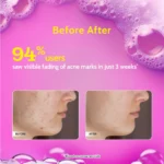 Chemist At Play 2% Salicylic Acid Face Wash for Acne & Oil Control - 100ml - Image 5