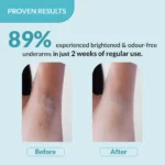 Fixderma Nigrifix Underarm Lightening Roll On - Image 7