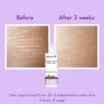 WishCare Collagen 1% Retinol Body Lotion - For Skin Tightening & Firming - Image 6