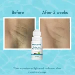 WishCare Under Arm Roll On Serum - Image 3