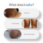 Be Bodywise Pigmentation Cream 100gm - Image 5