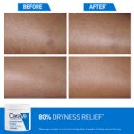 CeraVe Moisturizing Cream For Dry To Very Dry Skin (454g) - Image 3