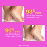 Chemist At Play Foot Roll-on for Cracked Heels & Diabetic Foot - 50 gm - Image 8