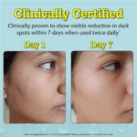 Chemist At Play 10% Vitamin C Serum for Glowing Skin - Image 8